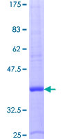 12.5% SDS-PAGE Stained with Coomassie Blue.
